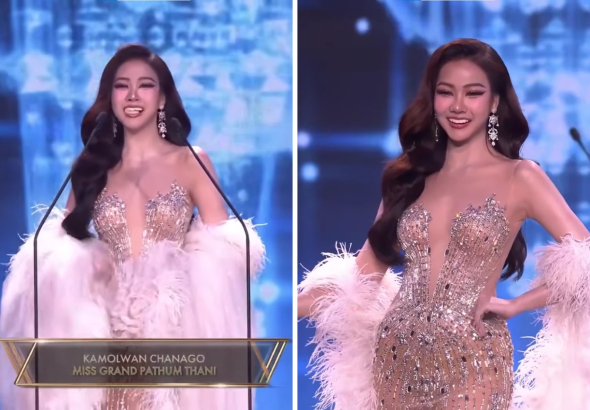 Veneer Gigi Kontestan Miss Grand Thailand 2026 Lepas saat Tampil di Atas Panggung